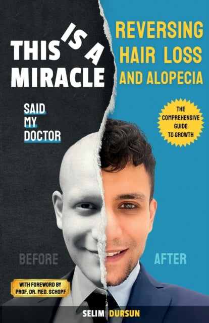 Dursun - THIS IS A MIRACLE SAID MY DOCTOR REVERSING HAIR LOSS AND ALO