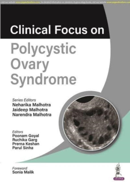 Narendra Malhotra - Clinical Focus on Polycystic Ovary Syndrome - New