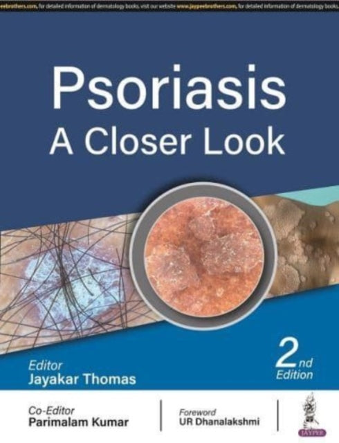 omas - Psoriasis A Closer Look - New paperback or softback