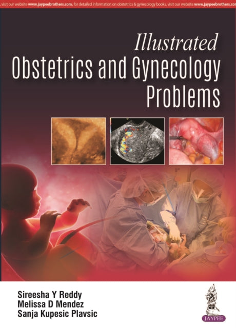 Reddy - Illustrated Obstetrics and Gynecology Problems - New paperback