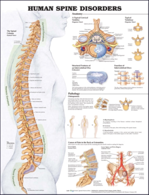Human Spine Disorders Anatomical Chart - Wallchart