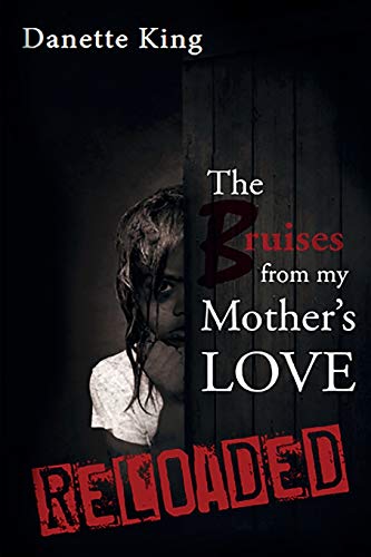 King - Bruises from my Mother's Love - New paperback or softback