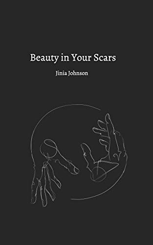 Johnson - Beauty In Your Scars - New paperback or softback