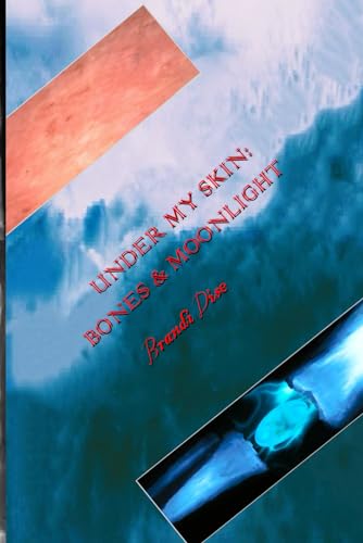 Dis - Under My Skin: Bones and Moonlight - New paperback or softback