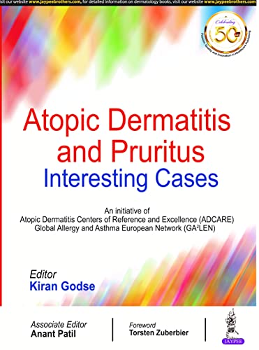 Gods - Atopic Dermatitis and Pruritus : Interesting Cases - New paperb