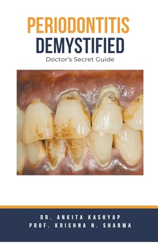 Kashyap - Periodontitis Demystified: Doctor's Secret Guide - New paper