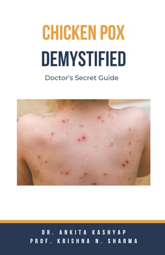 Kashyap - Chickenpox Demystified: Doctor's Secret Guide - New paperbac