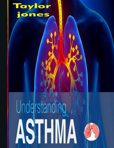 JONES S.D.C. - UNDERSTANDING ASTHMA MANAGING AND MINIMIZING THE IMP