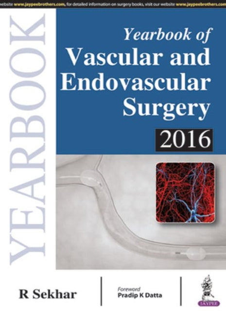 Sekhar - Yeabook of Vascula and Endovascula Sugey 2016 - New paperback