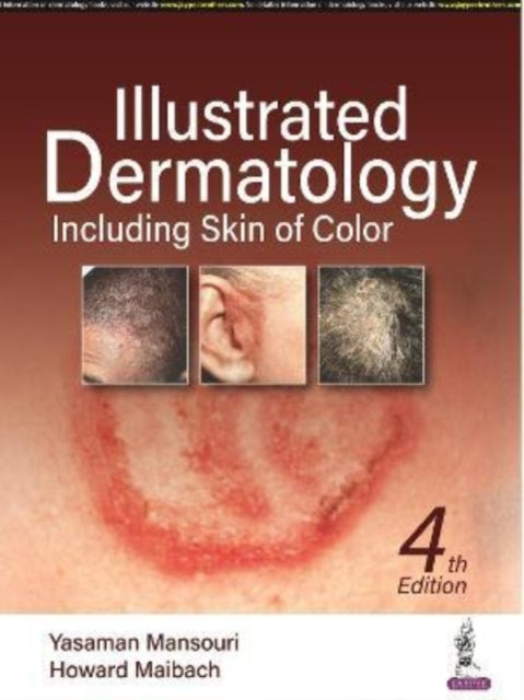 Howard Maibac - Illustrated Dermatology Including Skin of Colour - N