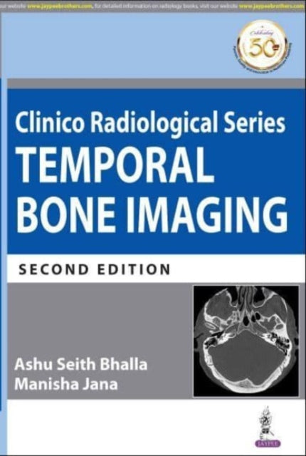 Bhalla - Clinico Radiological Series Temporal Bone Imaging - New pape