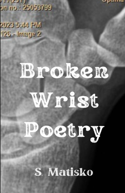 Matisko - Broken Wrist Poetry - New paperback or softback