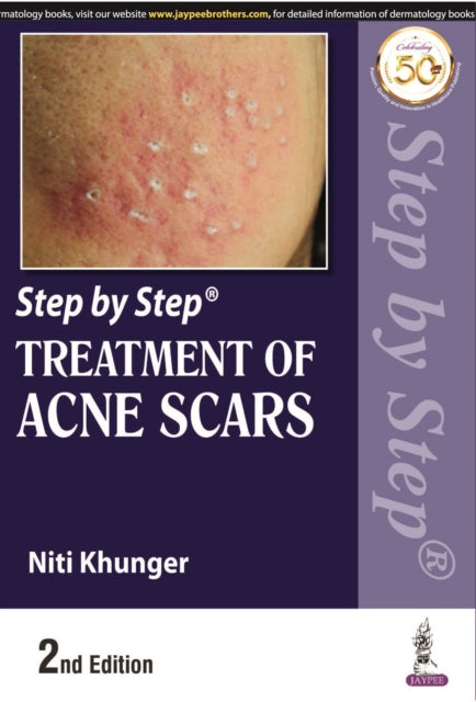Khunger - Step by Step Treatment of Acne Scars - New paperback or soft