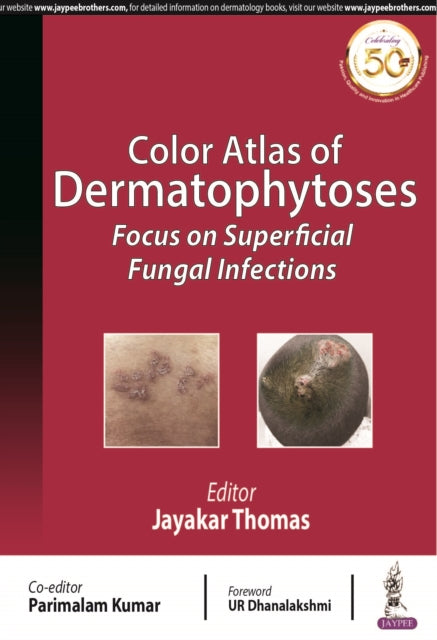 omas - Color Atlas of Dermatophytoses Focus on Superficial Fungal In