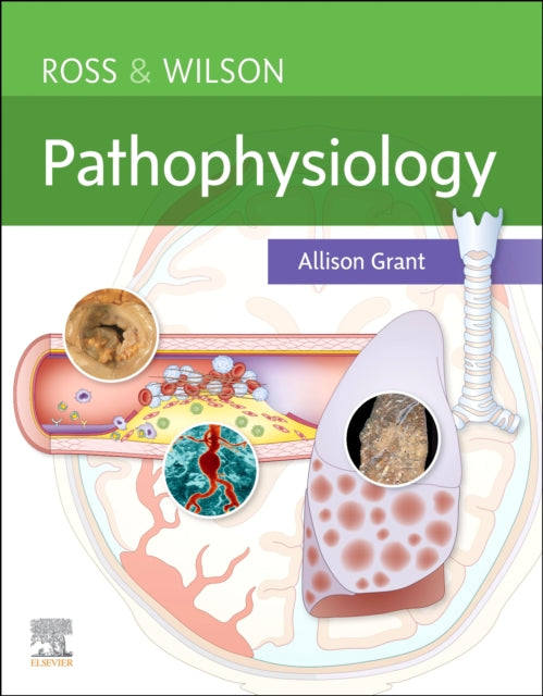 Allison BSc PhD RGN - Ross & Wilson Pathophysiology - Paperback