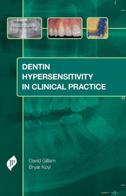 Gillam - Dentin Hypersensitivity in Clinical Practice - New hardback o