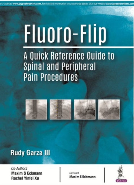 Garza - Fluoro-Flip   A Quick Reference Guide to Spinal and Peripheral