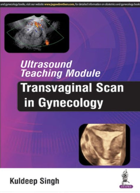 Sing - Ultrasound Teaching Module  Transvaginal Scan in Gynecology - N