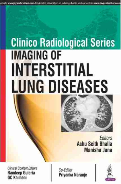 Bhalla - Clinico Radiological Series  Imaging of Interstitial Lung Dis
