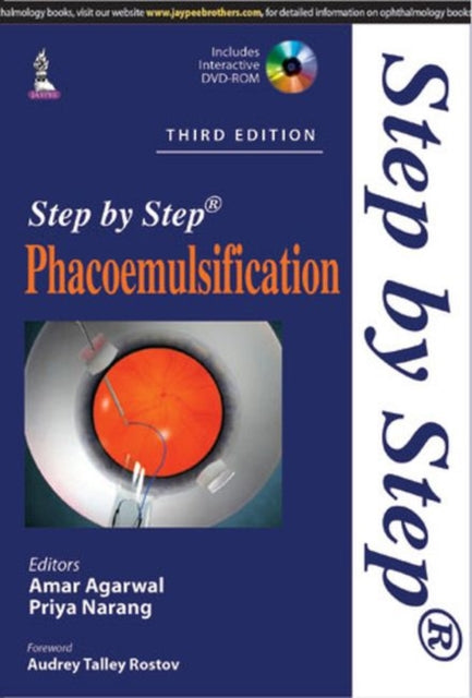 Agarwal - Step by Step Phacoemulsification - New paperback or softback