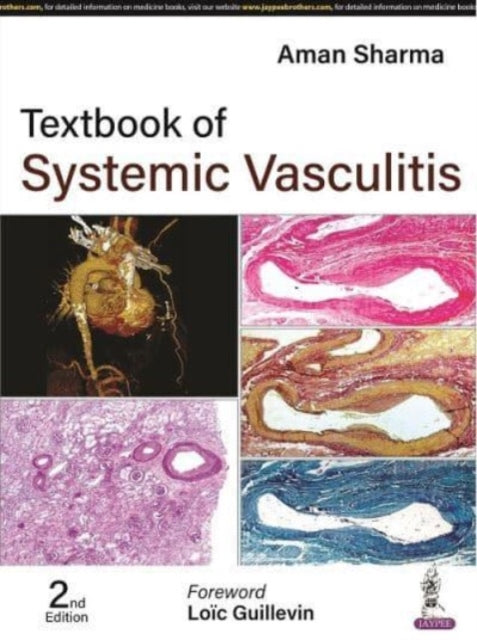 Sharma - Textbook of Systemic Vasculitis - New hardback or cased book
