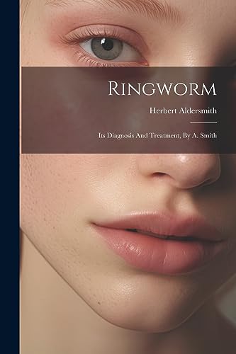 Aldersmit - Ringworm: Its Diagnosis And Treatment, By A. Smith - New p