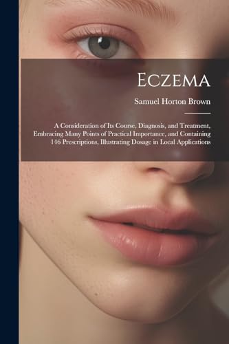 Brown - Eczema: A Consideration of Its Course, Diagnosis, and Treatmen