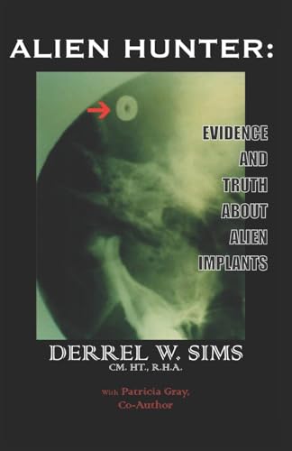 Sims - Alien Implants  Evidence & Truth about Alien Implants - New pap