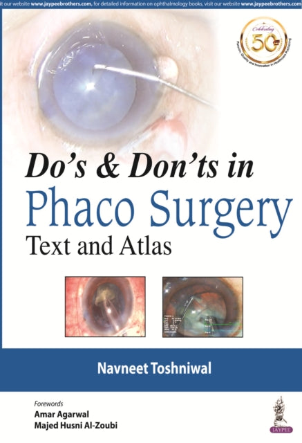 oshniwal - Do's & Dont's in Phaco Surgery   Text and Atlas - New paper