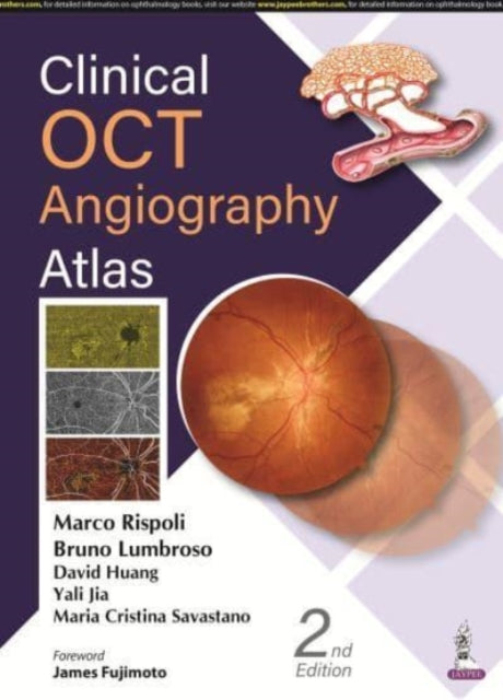 Rispoli - Clinical OCT Angiography Atlas - New hardback or cased book