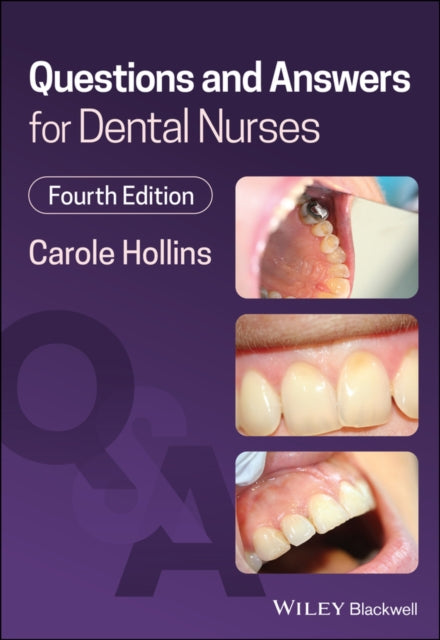 C Hollins - Questions and Answers for Dental Nurses 4th Edition - Pape