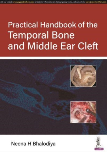 Bhalodiya - Practical Handbook of the Temporal Bone and Middle Ear Cle