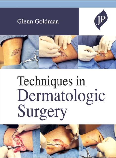Goldman - Techniques in Dermatologic Surgery - New hardback or cased b